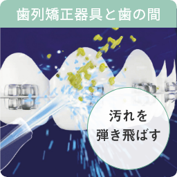 歯列矯正器具と歯の間 汚れを弾き飛ばす