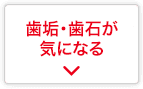 歯垢・歯石が気になる